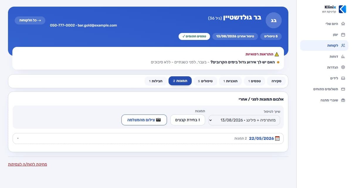 אלבום תמונות לפני ואחרי בכרטיס מטופלת ב-Klinix, עם שיוך לטיפול וצילום מהמצלמה